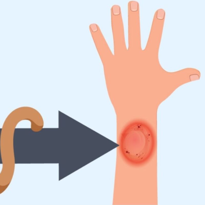 Biện pháp vệ sinh và chăm sóc tại nhà.