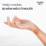 Tìm hiểu triệu chứng bị nấm mèo ở người.